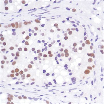 Anti-Androgen Receptor (C-term) antibody, Rabbit monoclonal clone SP242, recombinant, expressed in proprietary host, affinity isolated antibody