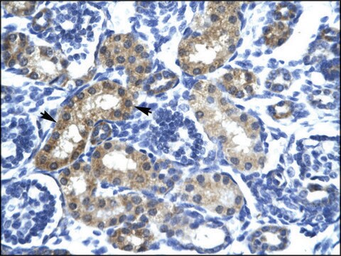 Anti-SIX6 antibody produced in rabbit affinity isolated antibody