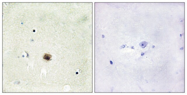 Anti-CRP1 antibody produced in rabbit affinity isolated antibody