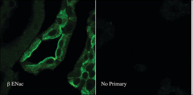 Anti-SCNN1B antibody produced in rabbit 1&#160;mg/mL, affinity isolated antibody