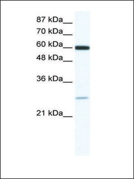 Anti-ZFP91 (AB1) antibody produced in rabbit affinity isolated antibody