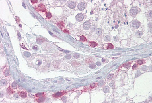 Anti-SYCP1 antibody produced in rabbit affinity isolated antibody