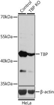 Anti-TBP antibody produced in rabbit