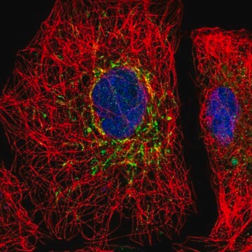 Anti-SLC25A35 antibody produced in rabbit Prestige Antibodies&#174; Powered by Atlas Antibodies, affinity isolated antibody, buffered aqueous glycerol solution