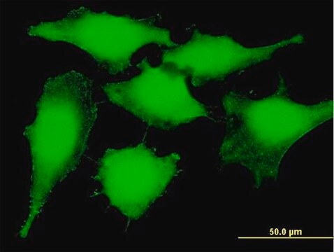 Anti-PSMB5 antibody produced in mouse purified immunoglobulin, buffered aqueous solution