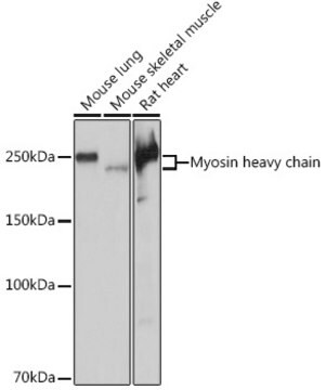 Anti-Myosin heavy chain Antibody, clone 6V0G1, Rabbit Monoclonal