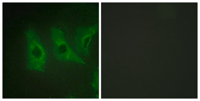 Anti-CKI-&#945; antibody produced in rabbit affinity isolated antibody