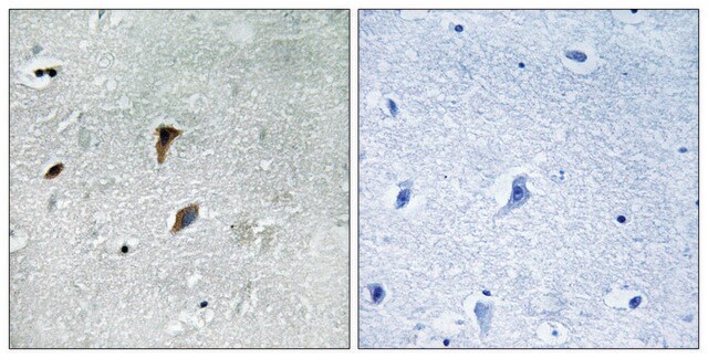 Anti-phospho-MAP2K3 (pThr222) antibody produced in rabbit affinity isolated antibody