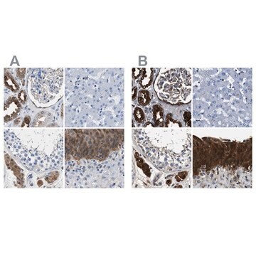 Anti-GSTP1 antibody produced in rabbit Prestige Antibodies&#174; Powered by Atlas Antibodies, affinity isolated antibody, buffered aqueous glycerol solution, Ab2