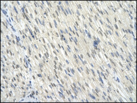 Anti-KLF10 antibody produced in rabbit affinity isolated antibody