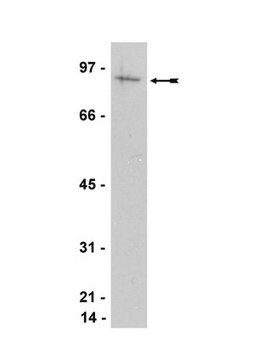 Anti-ATRIP Antibody Upstate&#174;, from rabbit