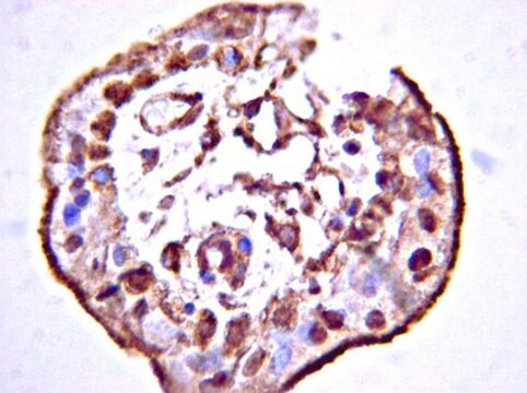 Anti-Stabilin-1 Antibody, CT from rabbit