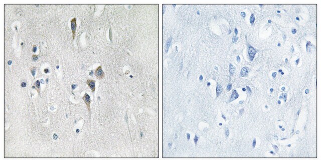 Anti-CAMK2 antibody produced in rabbit affinity isolated antibody