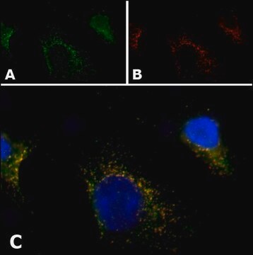 Anti-PMP70 antibody, Mouse monoclonal clone 70-18, purified from hybridoma cell culture