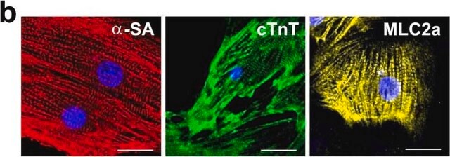 Anti-&#945;-Actinin (Sarcomeric) antibody, Mouse monoclonal clone EA-53, purified from hybridoma cell culture