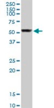 Anti-TUBB1 antibody produced in rabbit purified immunoglobulin, buffered aqueous solution