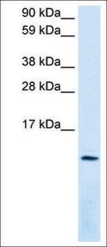 Anti-CXCL12 antibody produced in rabbit affinity isolated antibody