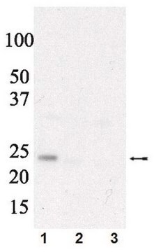 Anti-phospho eIF4E (Ser209) Antibody Upstate&#174;, from rabbit