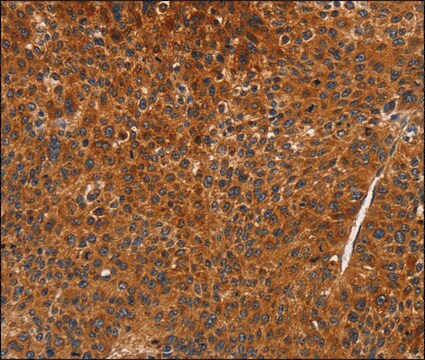 Anti-CDK19 antibody produced in rabbit affinity isolated antibody