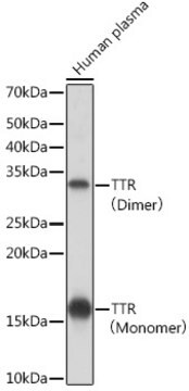 Anti-TTR Antibody, clone 5H4L7, Rabbit Monoclonal