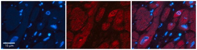 Anti-UPF1 antibody produced in rabbit affinity isolated antibody