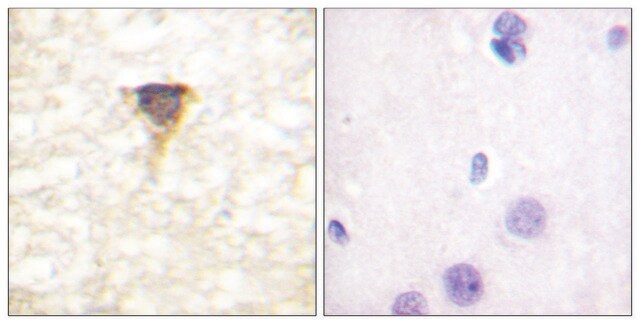 Anti-CAMK4 antibody produced in rabbit affinity isolated antibody