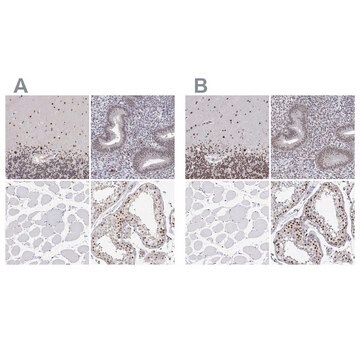 Anti-ADAR antibody produced in rabbit Prestige Antibodies&#174; Powered by Atlas Antibodies, affinity isolated antibody, buffered aqueous glycerol solution