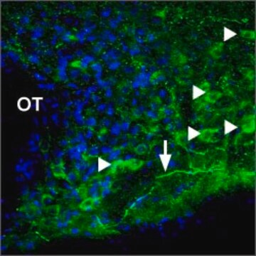 Anti-P2X1 Purinergic Receptor antibody produced in rabbit affinity isolated antibody, lyophilized powder