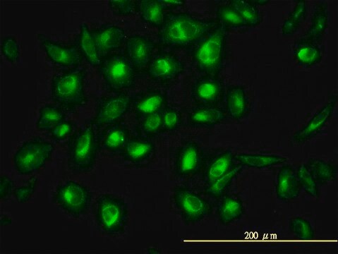 Monoclonal Anti-COG7 antibody produced in mouse clone 3G4-1B3, purified immunoglobulin, buffered aqueous solution