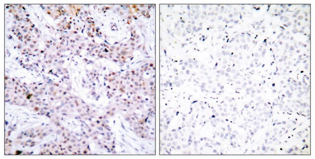 Anti-Estrogen Receptor-&#945; antibody produced in rabbit affinity isolated antibody