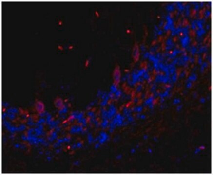 Anti-TMEM106B Antibody, clone TME-N 6F2 clone TME-N 6F2, from rat