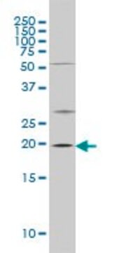 Monoclonal Anti-CRYAB antibody produced in mouse clone 1A10-1A4, purified immunoglobulin, buffered aqueous solution