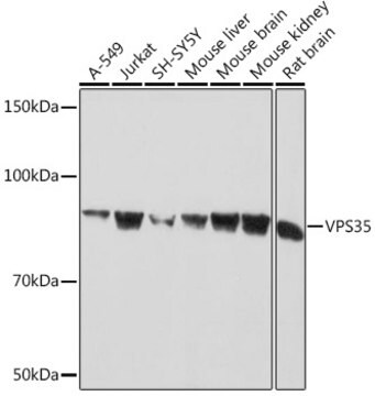 Anti-VPS35 Antibody, clone 8D3L3, Rabbit Monoclonal