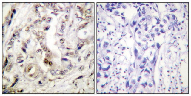 Anti-Progesterone Receptor antibody produced in rabbit affinity isolated antibody