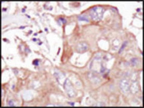 Anti-GLK (C-term) antibody produced in rabbit IgG fraction of antiserum, buffered aqueous solution