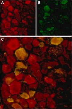 Anti-TRPV4 antibody produced in rabbit affinity isolated antibody, lyophilized powder