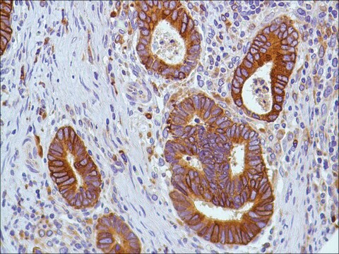 Anti-COX2 antibody, Rabbit monoclonal recombinant, expressed in proprietary host, clone SP21, tissue culture supernatant