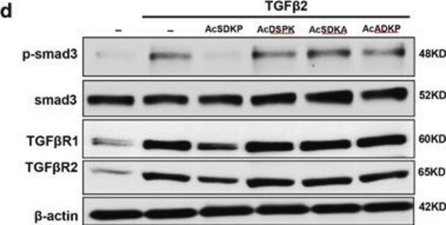 Anti-TGF &#946; Receptor I antibody produced in rabbit affinity isolated antibody