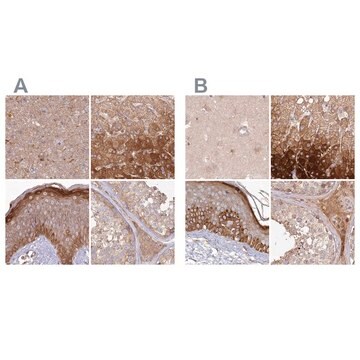 Anti-HAL antibody produced in rabbit Prestige Antibodies&#174; Powered by Atlas Antibodies, affinity isolated antibody, buffered aqueous glycerol solution