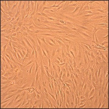 Human Osteoblasts-Osteoarthritis: HOb-OA, adult