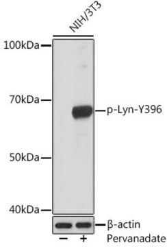 Anti-Phospho-Lyn-Y396 antibody produced in rabbit