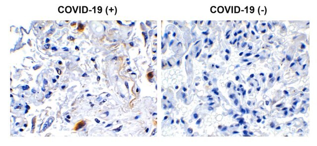 Anti-SARS-CoV-2 (COVID-19) NSP2 antibody produced in rabbit affinity isolated antibody