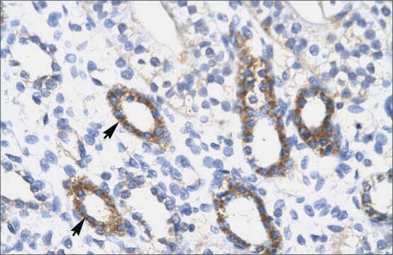 Anti-SOX10 antibody produced in rabbit affinity isolated antibody