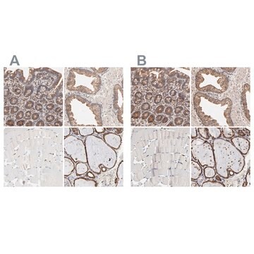 Anti-PDIA3 antibody produced in rabbit Ab2, Prestige Antibodies&#174; Powered by Atlas Antibodies, affinity isolated antibody, buffered aqueous glycerol solution