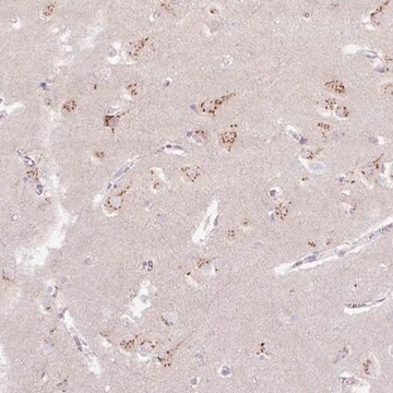 Anti-ABR antibody produced in rabbit Prestige Antibodies&#174; Powered by Atlas Antibodies, affinity isolated antibody, buffered aqueous glycerol solution