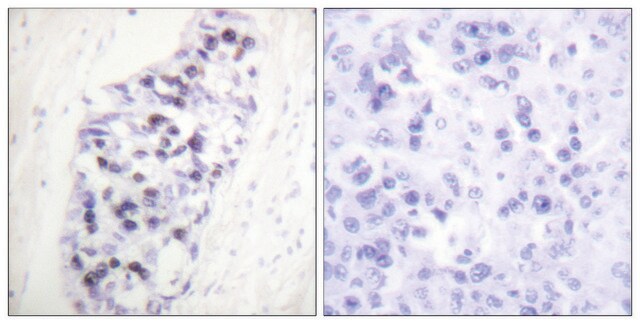 Anti-HDAC1 antibody produced in rabbit affinity isolated antibody