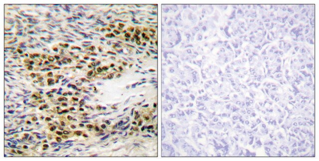 Anti-AKT antibody produced in rabbit affinity isolated antibody