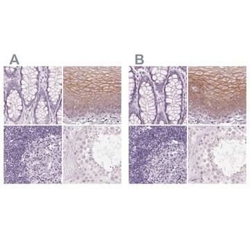 Anti-DSG3 antibody produced in rabbit Prestige Antibodies&#174; Powered by Atlas Antibodies, affinity isolated antibody, buffered aqueous glycerol solution