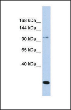 Anti-TRPC6, (N-terminal) antibody produced in rabbit affinity isolated antibody