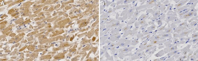 Anti-TRPV4 Antibody, clone 1G10-L2 ZooMAb&#174; Rabbit Monoclonal recombinant, expressed in HEK 293 cells